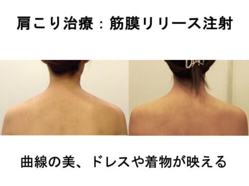 曲線の美、ドレスや着物が映える