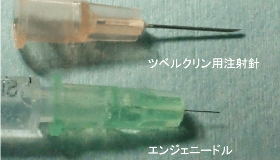 美容外科の技術力