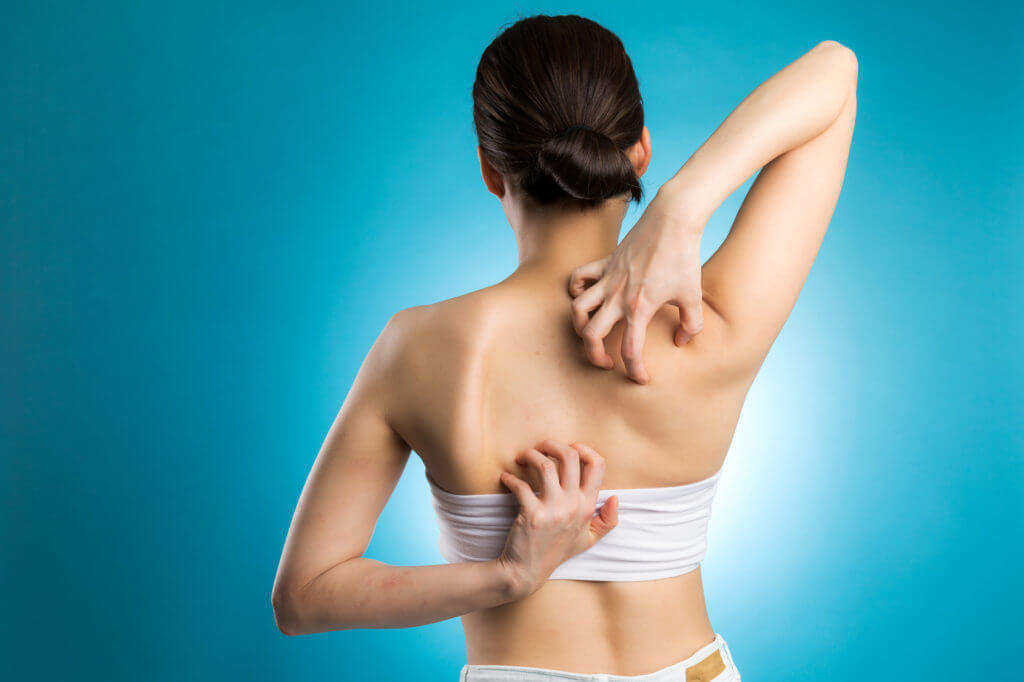 冬から始める乾燥肌対策