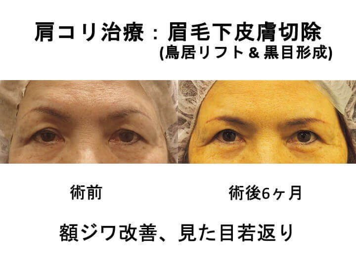 額ジワ改善、見た目若返り