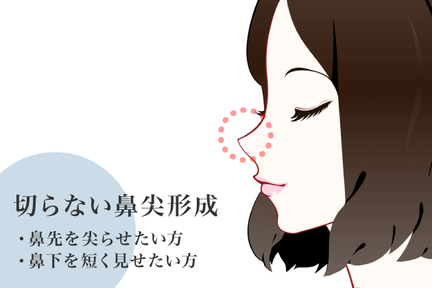 切らない鼻尖形成