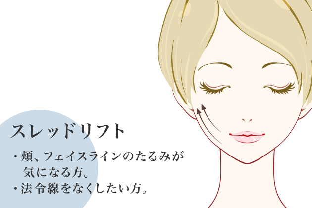 スレッドリフト