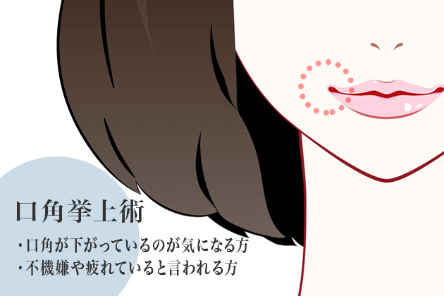 口角挙上術
