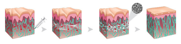 GOURI（ゴウリ）の作用