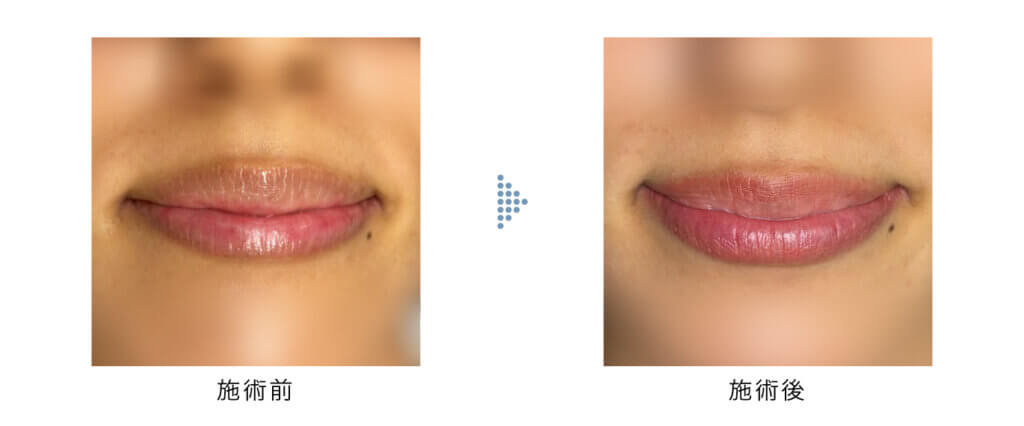 リップアートメイク