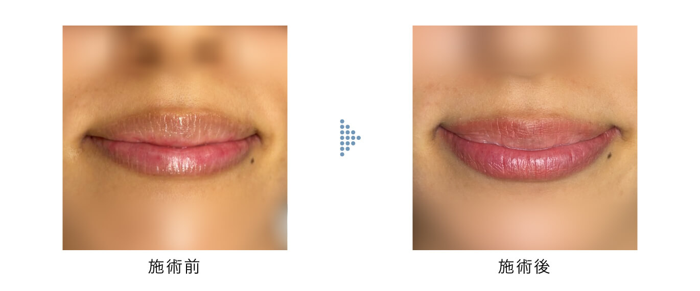 リップアートメイク