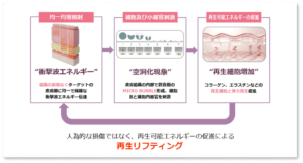 リフトーンの肌再生リフティング